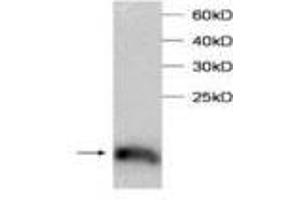 Image no. 1 for anti-Transcription Elongation Factor B (SIII), Polypeptide 2 (18kDa, Elongin B) (TCEB2) antibody (ABIN791478) (TCEB2 抗体)