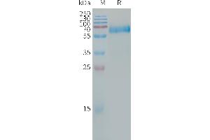 Human CA Protein, hFc Tag on SDS-PAGE under reducing condition.