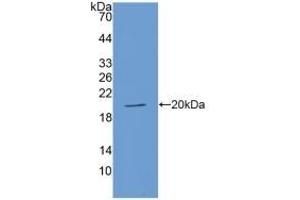 Detection of Recombinant ACE, Human using Polyclonal Antibody to Angiotensin I Converting Enzyme (ACE) (Angiotensin I Converting Enzyme 1 抗体  (AA 1160-1306))