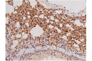 ABIN6269133 at 1/200 staining Mouse lung tissue sections by IHC-P. (KIT 抗体  (Internal Region))