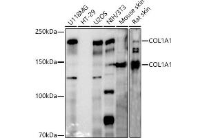 Western Blotting (WB) image for anti-Collagen, Type I, alpha 1 (COL1A1) (AA 100-200) antibody (ABIN6138837)