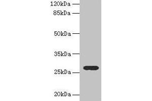 Western blot All lanes: TEX35 antibody at 4 μg/mL + U251 whole cell lysate Secondary Goat polyclonal to rabbit IgG at 1/10000 dilution Predicted band size: 27, 26, 24, 21, 25 kDa Observed band size: 27 kDa (TEX35 抗体  (AA 1-215))