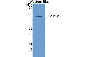 Western blot analysis of the recombinant protein. (PKC gamma 抗体  (AA 351-614))