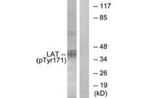 Western blot analysis of extracts from Jurkat cells treated with UV 15', using LAT (Phospho-Tyr171) Antibody. (LAT 抗体  (pTyr200))