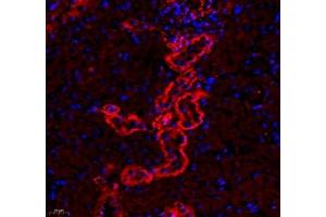 Immunofluorescence of paraffin embedded mouse kidney using CD240d (ABIN7075412) at dilution of 1: 500 (400x lens) (RHD 抗体)