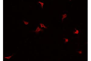 ABIN6269219 staining HUVEC cells by IF/ICC. (Cadherin 5 抗体  (C-Term))