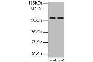Western blot All lanes: IMPDH2 antibody at 2 μg/mL Lane 1: EC109 whole cell lysate Lane 2: 293T whole cell lysate Secondary Goat polyclonal to rabbit IgG at 1/15000 dilution Predicted band size: 56 kDa Observed band size: 56 kDa (IMPDH2 抗体  (AA 5-514))