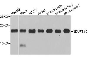 Western blot analysis of extracts of various cell lines, using NDUFB10 antibody. (NDUFB10 抗体  (AA 1-172))