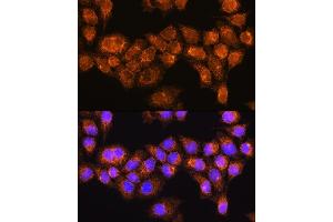 Immunofluorescence analysis of HeLa cells using R Rabbit pAb (ABIN7269787) at dilution of 1:100. (RABL3 抗体  (AA 1-236))