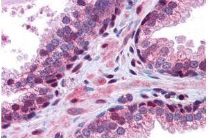 Human Prostate: Formalin-Fixed, Paraffin-Embedded (FFPE) (GID8/C20orf11 抗体  (C-Term))