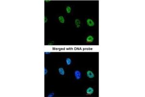 ICC/IF Image Immunofluorescence analysis of paraformaldehyde-fixed HeLa, using TAP , antibody at 1:200 dilution. (NXF1 抗体  (N-Term))