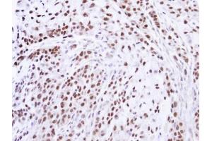 IHC-P Image Immunohistochemical analysis of paraffin-embedded A549 xenograft , using ZNF346, antibody at 1:100 dilution. (ZNF346 抗体)