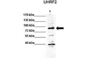 WB Suggested Anti-Uhrf2 Antibody  Positive Control: Lane 1: 60ug HCT116 lysate  Primary Antibody Dilution :  1:1000 Secondary Antibody : Anti rabbit-HRP  Secondry Antibody Dilution :  1:5,000 Submitted by: Chinweike Ukomadu, Brigham and Women's Hospital, Boston (UHRF2 抗体  (N-Term))