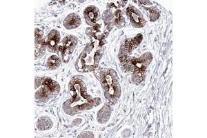 Immunohistochemical staining of human breast with KIAA1586 polyclonal antibody  shows strong cytoplasmic positivity in glandular cells at 1:50-1:200 dilution. (KIAA1586 抗体)