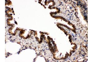 IHC(P): Rat Lung Tissue (MAP2K7 抗体  (N-Term))