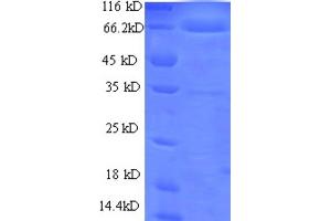 SDS-PAGE (SDS) image for Ornithine Decarboxylase 1 (ODC1) (AA 1-461), (full length) protein (GST tag) (ABIN1607948)