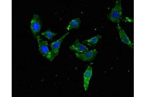 Immunofluorescent analysis of Hela cells using ABIN7172536 at dilution of 1:100 and Alexa Fluor 488-congugated AffiniPure Goat Anti-Rabbit IgG(H+L) (TFEB 抗体  (AA 1-476))