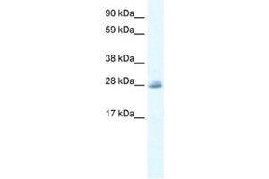 Western Blotting (WB) image for anti-Chloride Channel 5 (CLCN5) antibody (ABIN2461121) (Chloride Channel 5 抗体)