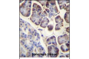 RPL34 Antibody (Center) (ABIN657131 and ABIN2846275) immunohistochemistry analysis in formalin fixed and paraffin embedded human pancreas tissue followed by peroxidase conjugation of the secondary antibody and DAB staining. (RPL34 抗体  (AA 37-66))