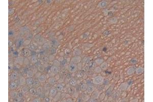 Detection of MAPT in Rat Cerebrum Tissue using Polyclonal Antibody to Tau Protein (MAPT) (tau 抗体  (AA 34-368))