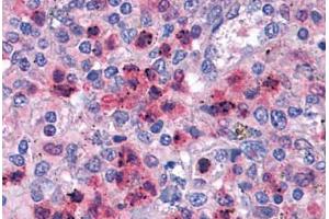 Human Neutrophils: Formalin-Fixed, Paraffin-Embedded (FFPE) (IRF4 抗体  (AA 342-452))
