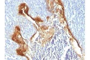 Formalin-fixed, paraffin-embedded human Tonsil stained with Involucrin Monoclonal Antibody (IVRN/827) (Involucrin 抗体)