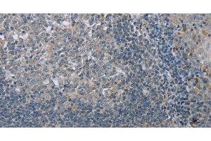 Immunohistochemistry of paraffin-embedded Human tonsil tissue using FAR2 Polyclonal Antibody at dilution 1:40 (FAR2 抗体)
