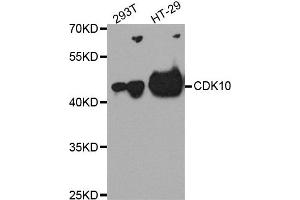 Western blot analysis of extract of 293T and HT-29 cells, using CDK10 antibody. (CDK10 抗体)