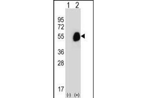 Western blot analysis of GCDH (arrow) using rabbit polyclonal GCDH Antibody (C-term) (ABIN656829 and ABIN2846038). (GCDH 抗体  (C-Term))