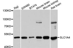 Western blot analysis of extracts of various cells, using SLC1A4 antibody. (SLC1A4 抗体)