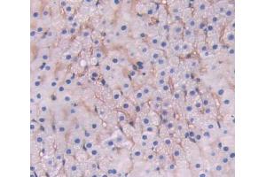 Used in DAB staining on fromalin fixed paraffin- embedded adrenal gland tissue (LRP1B 抗体  (AA 31-194))
