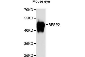 Western blot analysis of extracts of mouse eye, using BFSP2 antibody (ABIN6290111) at 1:3000 dilution. (BFSP2 抗体)