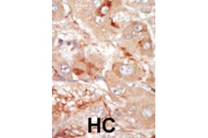 Immunohistochemistry (IHC) image for anti-Serine/threonine-Protein Kinase PRP4 Homolog (PRPF4B) antibody (ABIN3003283) (PRPF4B 抗体)