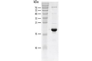 Western Blotting (WB) image for K(lysine) Acetyltransferase 2B (KAT2B) (AA 715-829) protein (His tag,DYKDDDDK Tag) (ABIN2669635)