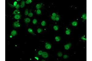Image no. 3 for anti-Spastic Paraplegia 7 (SPG7) (AA 300-573) antibody (ABIN1491369) (SPG7 抗体  (AA 300-573))