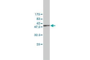 Western Blotting (WB) image for anti-Non-Metastatic Cells 1, Protein (NM23A) Expressed in (NME1) (AA 1-152) antibody (ABIN562003)