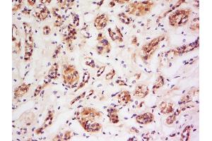 Formalin-fixed and paraffin embedded human kidney labeled with Anti-NOS-2/iNOS Polyclonal Antibody, Unconjugated  at 1:200 followed by conjugation to the secondary antibody and DAB staining. (NOS2 抗体  (AA 14-100))