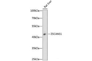 Western blot analysis of extracts of Rat liver using ZSCAN31 Polyclonal Antibody at dilution of 1:3000. (ZKSCAN2 抗体)