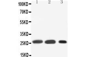 Anti-SFTPA1 antibody, Western blotting Lane 1: Rat Lung Tissue Lysate Lane 2: Rat Lung Tissue Lysate Lane 3: MK(55KD) (Surfactant Protein A1 抗体  (C-Term))