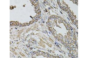 Immunohistochemistry of paraffin-embedded Human prostate using TMC1 Polyclonal Antibody at dilution of 1:100 (40x lens). (TMC1 抗体)