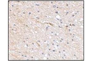 Immunohistochemical staining of human brain tissue using AP30769PU-N at 2. (FBXL20 抗体  (N-Term))