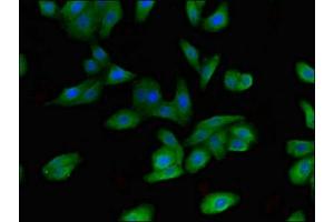 Immunofluorescent analysis of HepG2 cells using ABIN7152451 at dilution of 1:100 and Alexa Fluor 488-congugated AffiniPure Goat Anti-Rabbit IgG(H+L) (FBXO9 抗体  (AA 13-111))