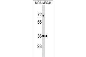 STX4 Antibody (Center) (ABIN1537824 and ABIN2850244) western blot analysis in MDA-M cell line lysates (35 μg/lane). (Syntaxin 4 抗体  (AA 132-160))