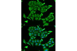 Immunofluorescence (IF) image for anti-MB antibody (ABIN1876659) (MB 抗体)