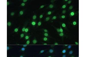 Immunofluorescence analysis of C6 cells using LBR Polyclonal Antibody at dilution of 1:100 (40x lens). (Lamin B Receptor 抗体)