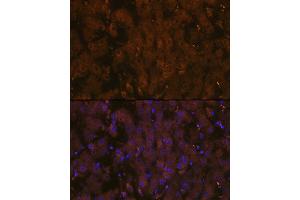 Immunofluorescence analysis of human liver using MSP/MST1 Rabbit mAb (ABIN1680891, ABIN1680890, ABIN3015057 and ABIN3015058) at dilution of 1:100 (40x lens). (MST1 抗体)