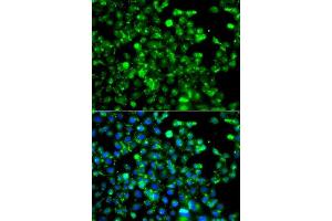 Immunofluorescence analysis of A549 cells using CAPN5 antibody. (Calpain 5 抗体  (AA 361-640))