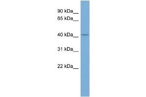 WB Suggested Anti-TRIM44 Antibody Titration: 0. (TRIM44 抗体  (Middle Region))