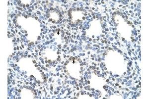 Immunohistochemistry (IHC) image for anti-Solute Carrier Family 15 (H+/Peptide Transporter), Member 4 (SLC15A4) (N-Term) antibody (ABIN635119)