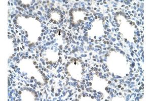 SLC15A4 antibody was used for immunohistochemistry at a concentration of 4-8 ug/ml to stain Alveolar cells (arrows) in Human Lung. (SLC15A4 抗体  (N-Term))